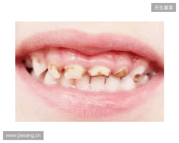 韦林顿确诊上唇部贯通伤;11、21牙半脱位;上颌前牙区牙槽骨骨折 韦林顿确诊上唇部贯通伤;11、21牙半脱位;上颌前牙区牙槽骨骨折